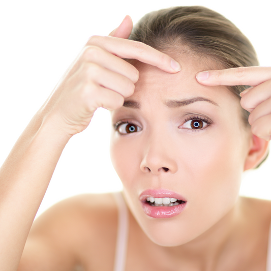 The success of acne care is based on a core program